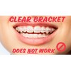 Snapcaps Braces Bumper Cover, Orthodontic Bracket Wax Substitute, Alternative Snap-on