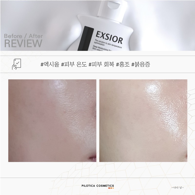 Philotica Exiol Water Glow Soothing Skin Temperature Serum 80ml, 1