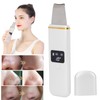 Skin Scrubber Spatula Ultrasonic Blackhead Comedones Removal Device Facial Scrubber