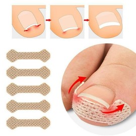60 Pcs Ingrown Toenail Treatment, Professional Ingrown Fingernail corrector, No Glue Breathable Corrector Patch at Home, Not easy to fall off, quick repair Ingrown Nail Treatment Tool, Nail Repair