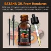 Aceite De Batana For El Crecimiento Del Cabello Con