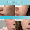 No.1 Pantothenic B5 Hyaluronic Active Clear Mask (10ea)
