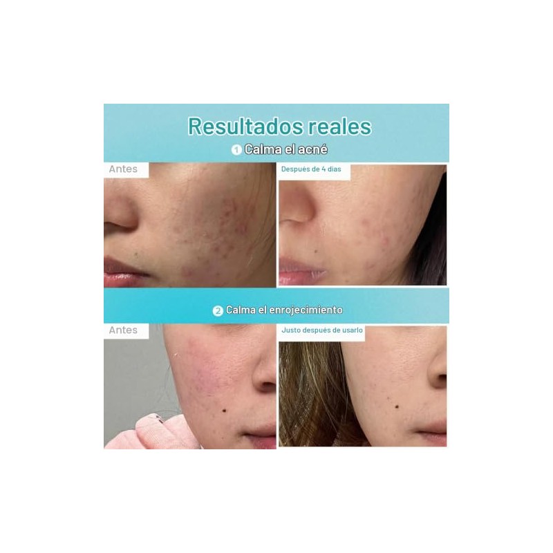 No.1 Pantothenic B5 Hyaluronic Active Clear Mask (10ea)