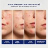 Suero Acido Salicílico 2% Con Niacinamida Antiacné 2 Pzs