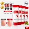 Foot comfort cream Urea Urea moisturizing foot cream foot callus softener, 100ml, 4 pieces, 1 piece / 발편안 크림 유리아 유레아 보습 풋 크림 발 각질 굳은살 연화제, 100ml, 4개, 1개입