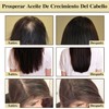 Aceite Natural Para el Crecimiento del Cabello, Aceite Orgánico De