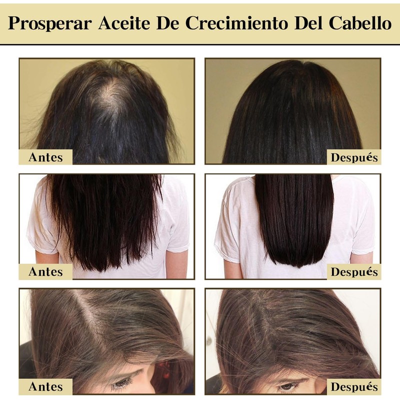 Aceite Natural Para el Crecimiento del Cabello, Aceite Orgánico De