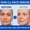 Copper Peptides Serum for Face – Firming, Rejuvenating, Collagen Enhancing