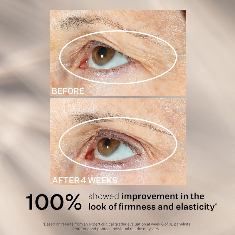 StriVectin Peptight 360 Tightening Suero tensor para el reafirma la