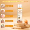 Bee Venom Nail Soothing Spray, Toe Nail Treatments for Damaged