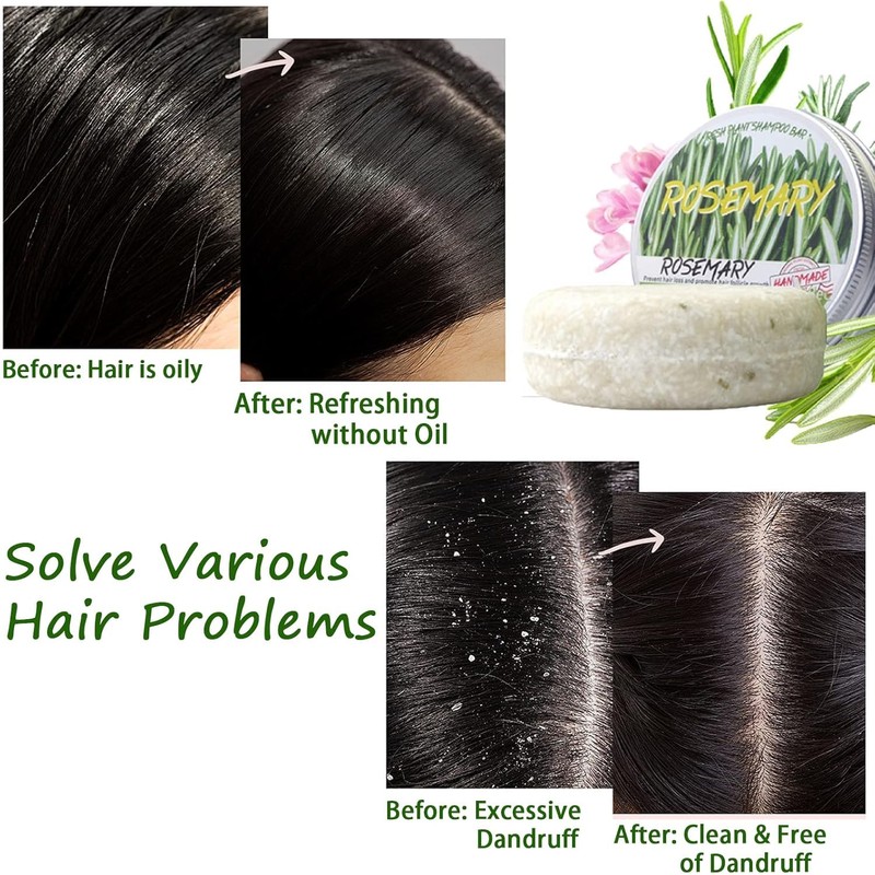 Champú Con Jengibre Para El Crecimiento Del Cabello, Champú Orgánico