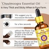 Deve Herbes Pure Chaulmoogra Oil (Hydnocarpus wightiana) Natural Therapeutic Grade