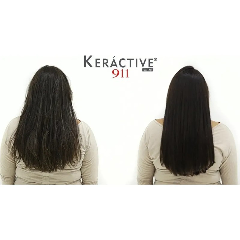 Nutrapel Keráctive 911 Sistema Integral de Reparación Shampoo300 ml+ Tratamiento
