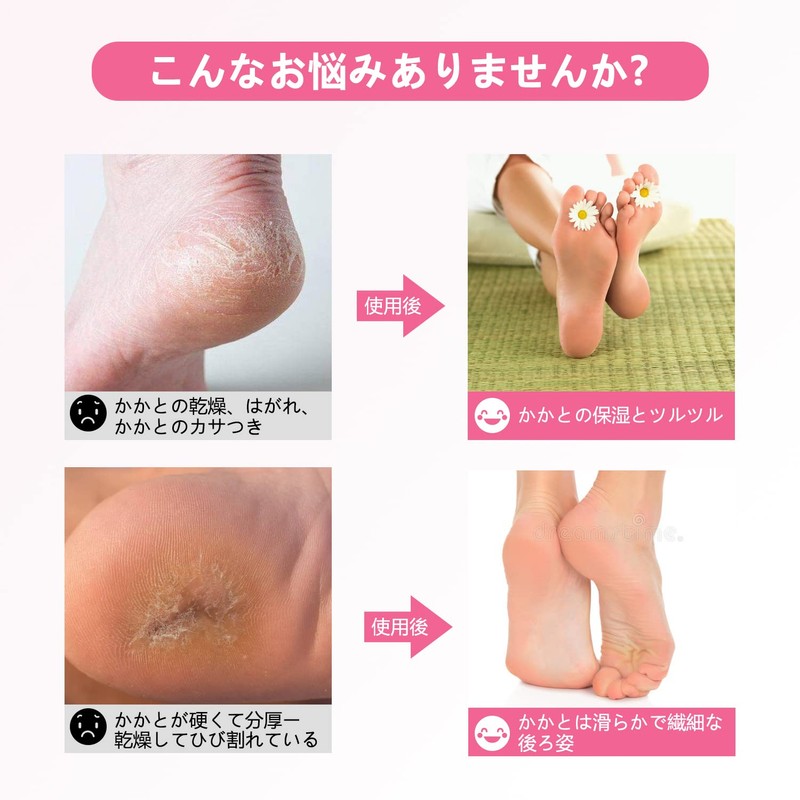 2足組 かかとケア靴下 かかと保湿ソックス ヒールケアソックス 角質ケア ひび割れ対策 ツルルツル かかとつるつるめ 保湿保護 就寝時間