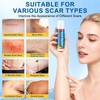 Scar Butter Stick with Vitamin E, Cocoa Butter & Coconut