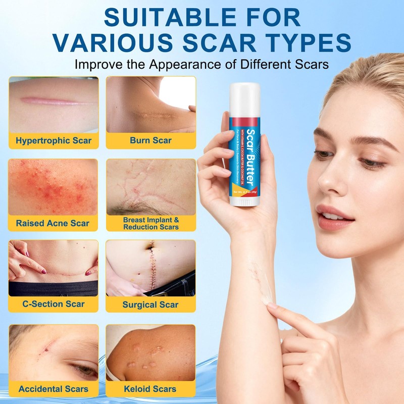 Scar Butter Stick with Vitamin E, Cocoa Butter & Coconut