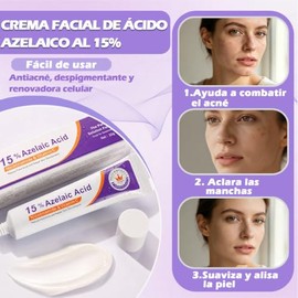 5PCS Crema cido Azelaico 15,Suero Facial Acido Azelaico,Crema Hidratante Facial Para Todo Tipo de Piel,Anti imperfecciones con cido Azelaico,cido...  