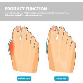 Homoyoyo 32 Piezas Separador de Dedos de Silicona, Reutilizables para Pedicura, Previene Ampollas y Dedos en Martillo, Uso Recomendado en Procesos de Pedicura y Cuidado Personal