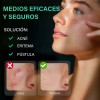 Parches Acné Lunixila Microagujas Día Noche con Ácido Salicílico Niacinamida