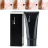 Deep Cleansing Pimple Remover Acne Black Mask + Pore Strip