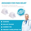 Nolimvita Hammer Toe Straightener Corrector - Toe Spacers Toe Splints