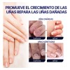 2 Piezas Líquido Reparador De Uñas De Los Pies, Paronychia