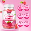 softbear L-Lysine Gummies for Adults & Kids, L Lysine 1000mg