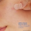 CeraVe Parches Anti Imperfecciones, Transparentes e Invisibles Sobre la Piel