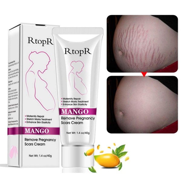 Reddhoon 2 Pack Mango Stretch Marks Scar Cream, Stretch Marks Treatment, Maternity Repair, Recovery Elasticity, Repair Scar Slack Line Abdomen Stretch Marks Postpartum