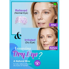 BeMyLady Heating Eye Mask Self Steam Eye Mask 20Pcs Mixed pack for Puffy Eyes,Dry Eyes,Blepharitis,Migraine,Fatigue Disposable Moist Hot Compress Eye Patch Great Gifts for Family and Friends