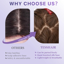 TESSHAIR Human Hair Topper with Bangs, 100% Remy Toppers Hair Pieces for Women, No Tangle & Smooth, Clip on Bangs 14 Inch #2R Chocolate Brown