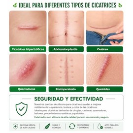 Parches Silicona Cicatrices Rollo Reutilizable Recortable Flexible Cómodo Grado Médico Ayuda Mejorar Apariencia Queloides Cesárea Cirugía Quemaduras