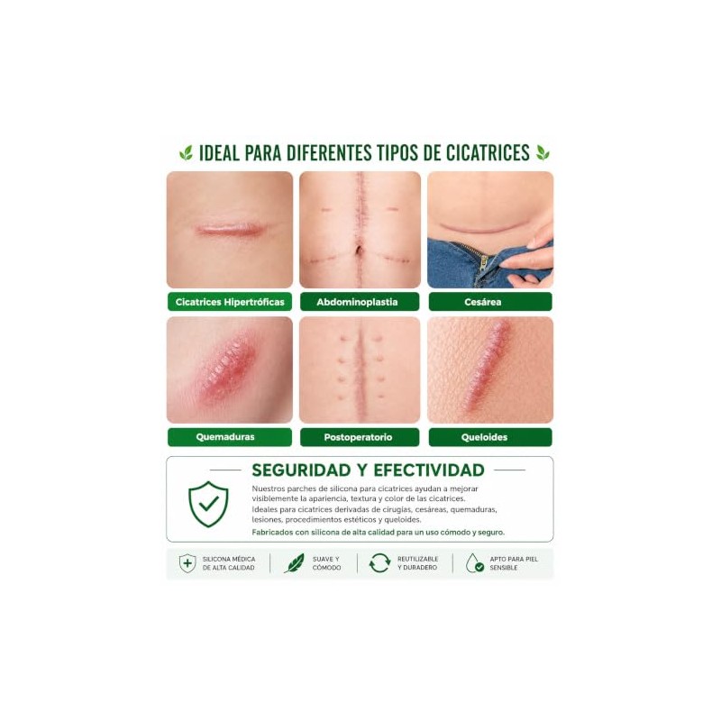 Parches Silicona Cicatrices Rollo Reutilizable Recortable Flexible Cómodo Grado Médico