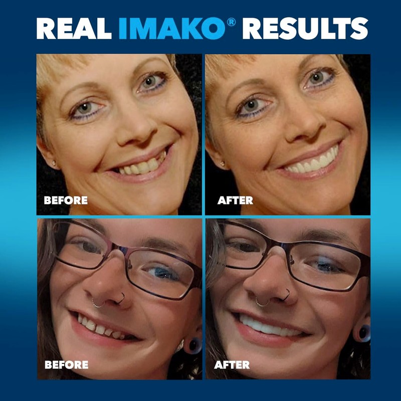 Imako Premium Cosmetic Uppers - 2 Pack - Small, Natural