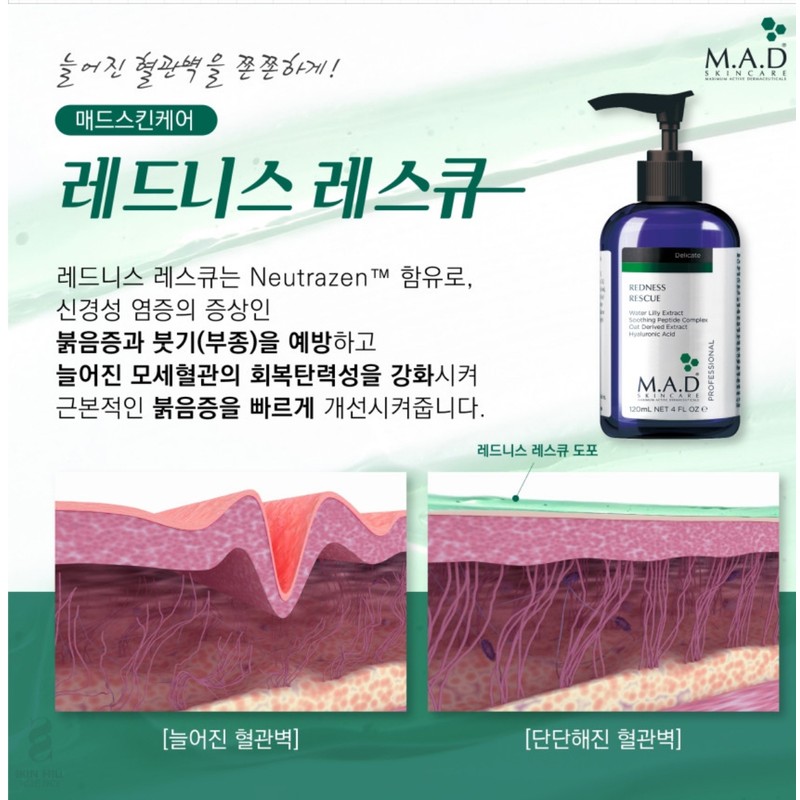 Mad Skin Tools Mega Rich Cleansing Gel and more Redness