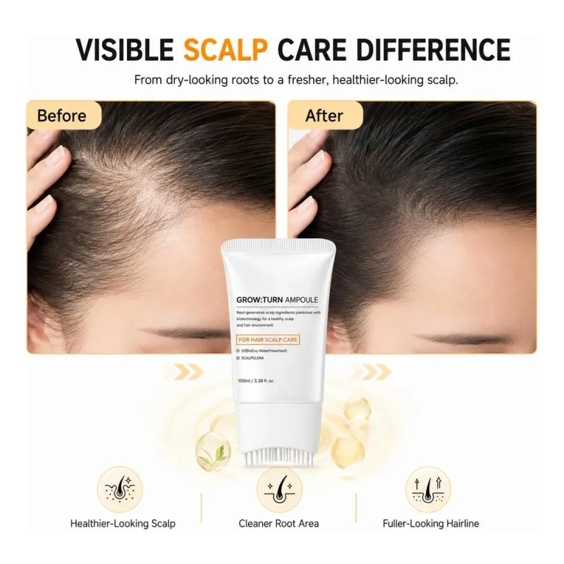 Suero For El Crecimiento Del Cabello Aume, Con Peine