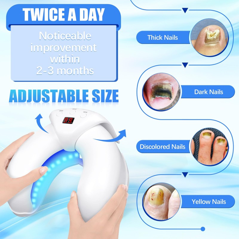 LEEWENYAN Nail Fungus Treatment Device, Highly Efficient Nail Fungus Cold