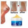 Crema Antisequedad Para Reparar Las Grietas De Los Pies Y