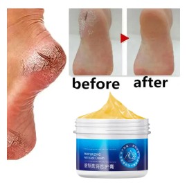 Crema Antisequedad Para Reparar Las Grietas De Los Pies Y El
