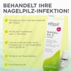 efasit Nagelpilz Lösung - Zur Behandlung von Nagelpilz, Nagellack bildet