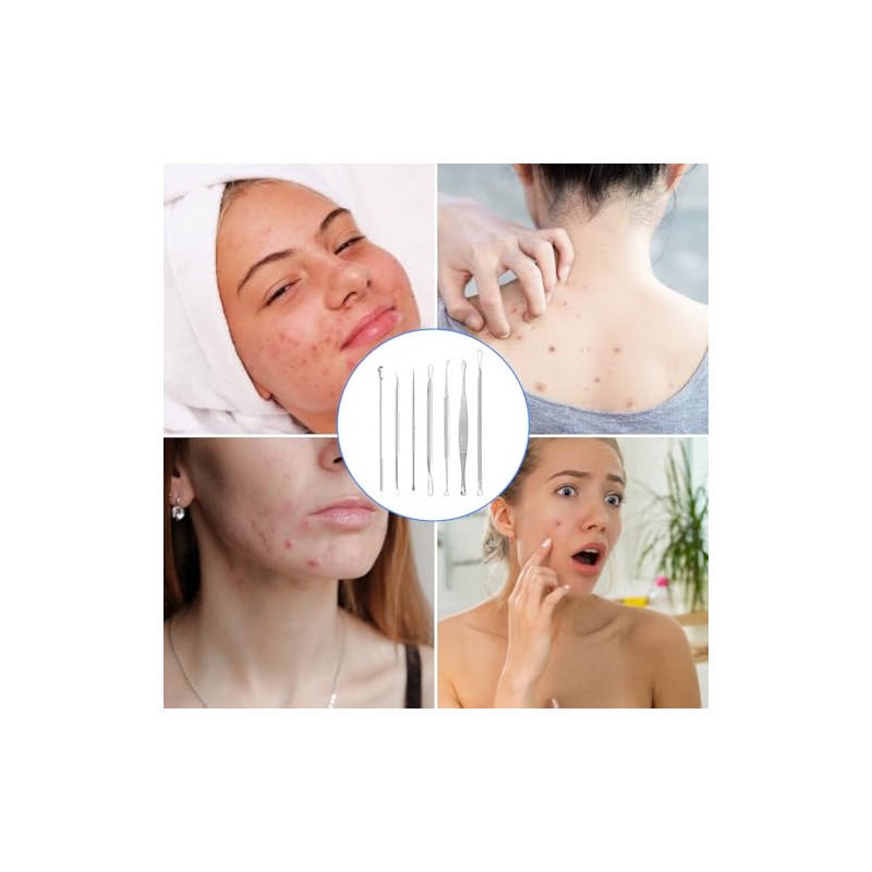 Nivofu 7Pcs Blackhead Remover Kit, Herramientas de Eliminación de Puntos