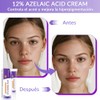 Piezas Suero Facial Ácido Azelaico Tono Piel Uniforme Crema Hidratante