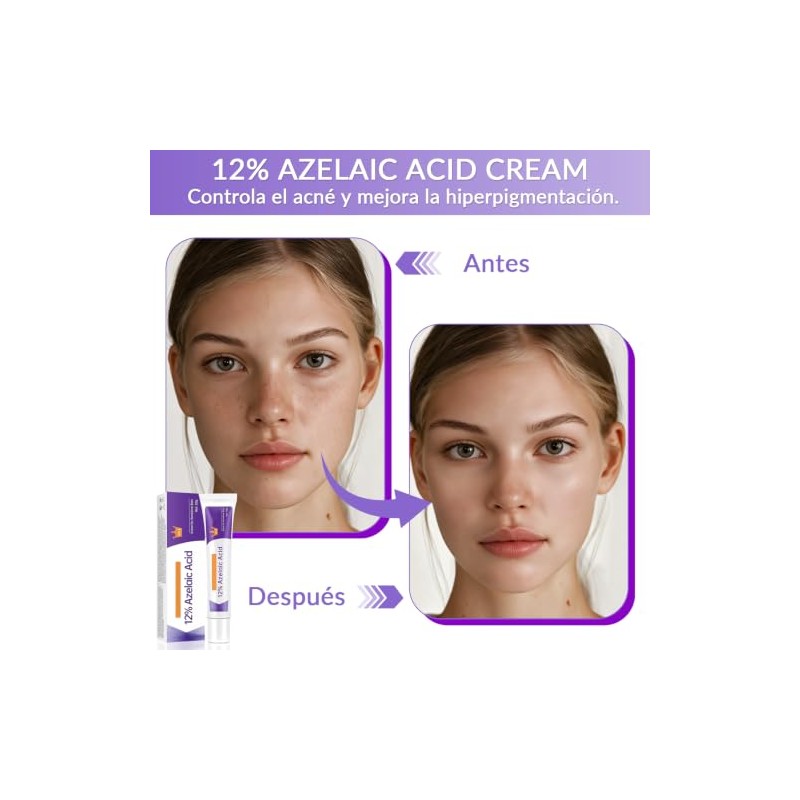 Piezas Suero Facial Ácido Azelaico Tono Piel Uniforme Crema Hidratante