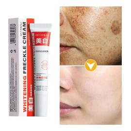 Crema Quitamanchas Hidratante 20g Para Rostro Todo Tipo De Piel Día/noche