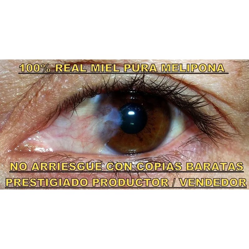 Gotas Oftálmicas Miel Melipona Ojos Cataratas Carnosidad
