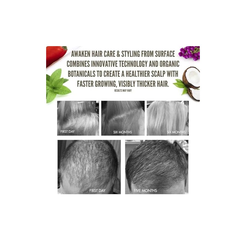Surface Awaken Therapeutic Masque 6 oz/177 ml