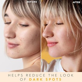 Tónico facial con vitamina C, fabricado en Estados Unidos con ingredientes naturales y orgánicos, tóner facial iluminador de piel sin alcohol para pie