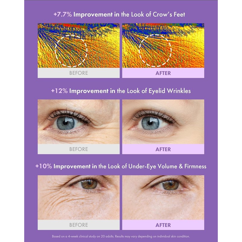 MAXCLINIC PDRN Crema de ojos – Advanced C-Zone Crema hidratante