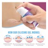 Scar Gel Vogsig Elimina Cicatrices Queloide Abdominoplastia