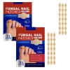 Parches De Cuidado Para Las Uñas,parche Corrector De Uñas